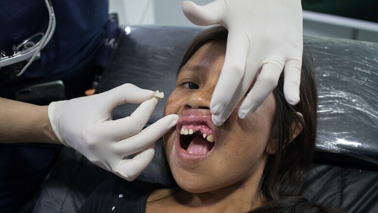 Figura 3. Joven paciente a quien le faltaba un diente en la posición 11.