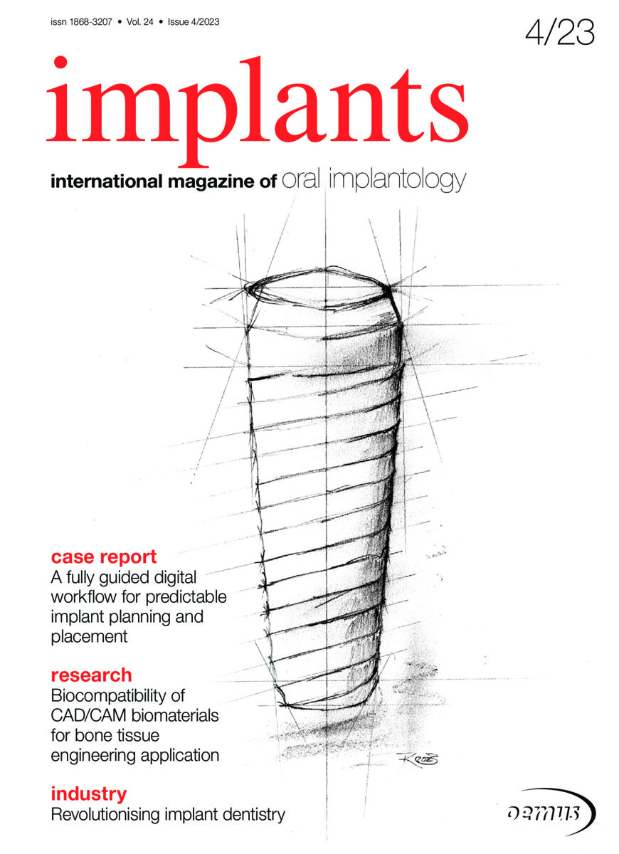 Dental Tribune EPaper Edition Implants International
