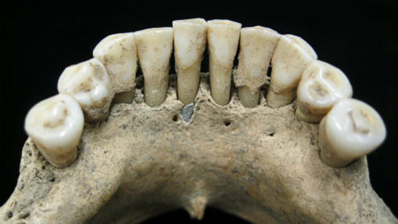 Researchers discover pigments of lapis lazuli in medieval woman’s jaw