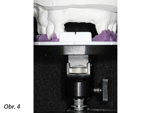 Obr. 4: Okluzní stojan s indexovým nosičem a upevněným dentálním modelem