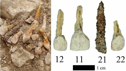 Scoperta dagli archeologi la più antica protesi dentaria