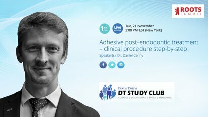 Expert to discuss adhesive post-endodontic treatment in free webinar