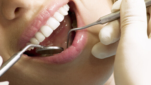 Admitere Medicina Dentara 2013: au inceput inscrierile!