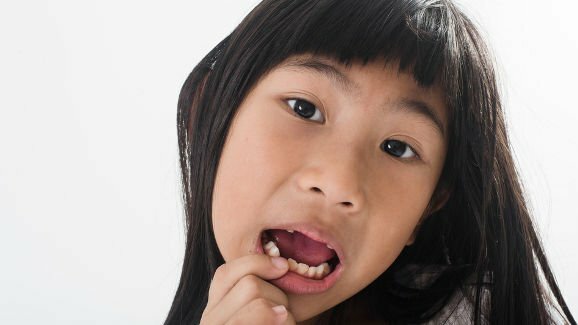 Metade das crianças de Osaka não vai ao dentista conforme recomendado