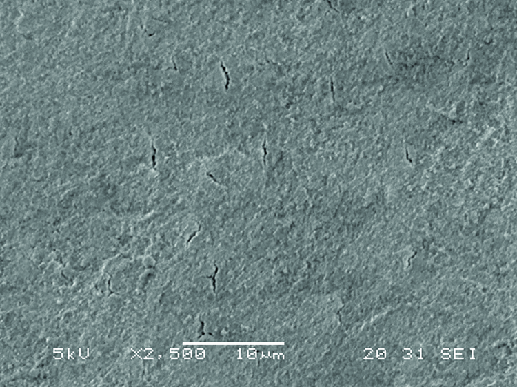 Fig. 2a: Scanning electron microscope (SEM) images of sealed and protected dentine surfaces after treatment with nHAp agent by PrevDent.