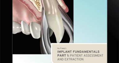 Hu-Friedy releases guide to implantology