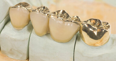 Decline of dental gold production continues