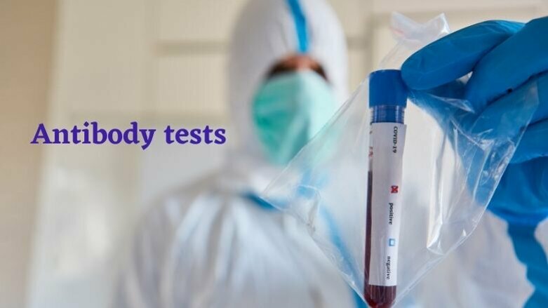 COVID-19 antibody tests not recommended for measuring immunity after vaccination