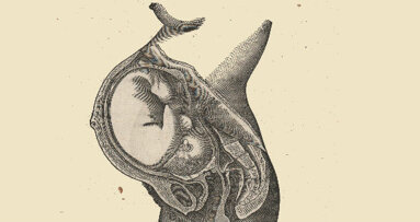 Prima rimozione di un cancro orale su un feto nell’utero