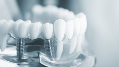 What is driving the European dental implant markets?