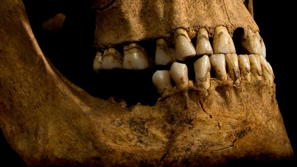 Teeth reveal details of Richard III’s lifestyle