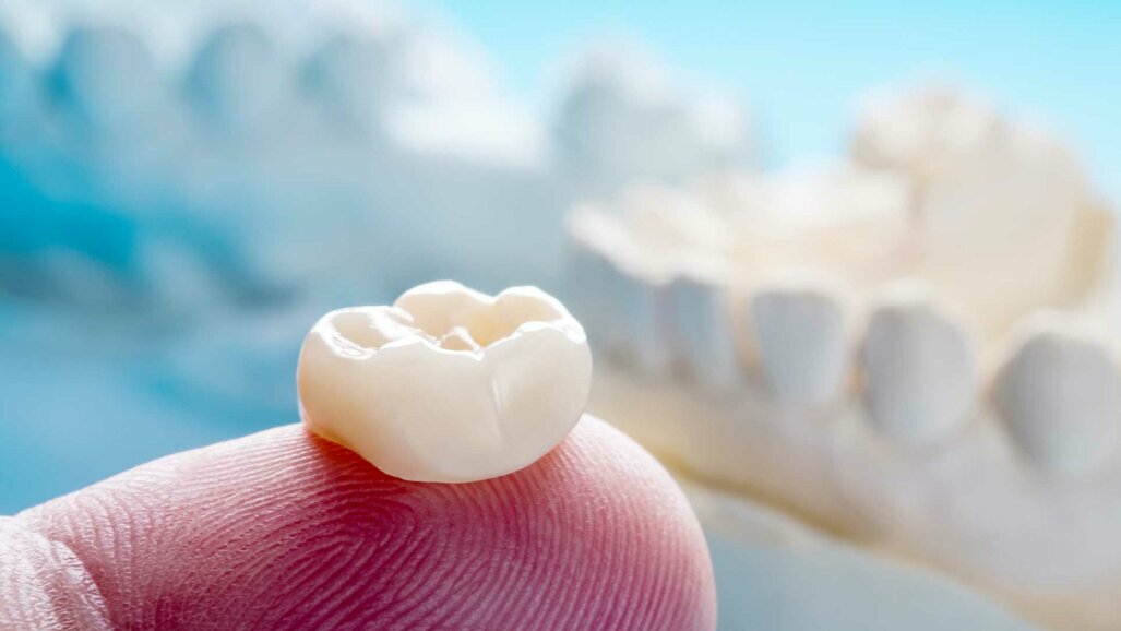 Essgewohnheiten durch Aminosäuren im Zahnschmelz erforscht
