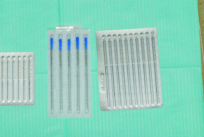 Aiguilles d’acupuncture actuelles, stérilisées et préemballées, utilisées pour le traitement