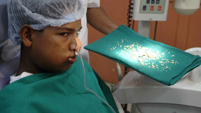 Mladiću iz Indije izvađeno preko dve stotine zuba