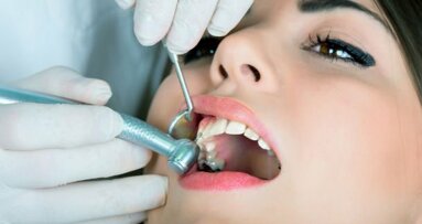 Forte, seguro e não corrosivo: óxido de grafeno testado para aplicação em odontologia