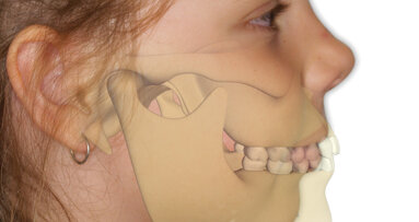 The nose knows: A big-picture look at myofunctional orthodontics
