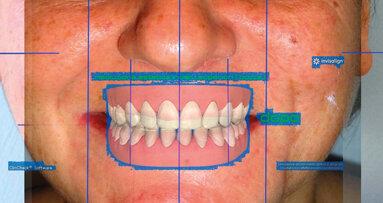 Il virtual planning tra allineamento estetico e cosmesi dentale