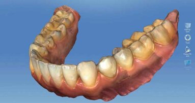 Sirona unveils products designed to enhance orthodontic practice productivity