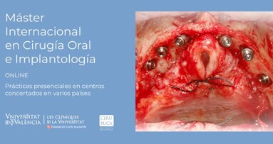 Primer Máster Internacional ONLINE en Cirugía Oral e lmplantología