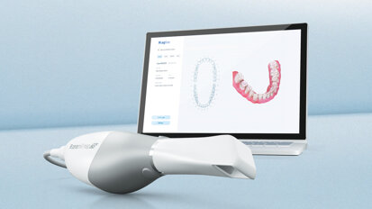 Extension of Ceramill CAD/CAM workflow—digital solutions lead the way into the dental practice