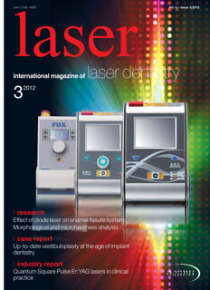 laser international No. 3, 2012