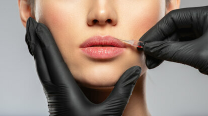 Kosmetyczne procedury injekcyjne w stomatologii