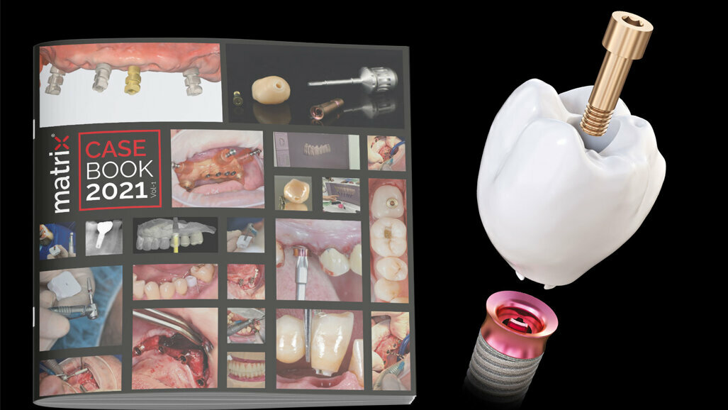TRI Dental Implants – matrix case book