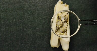 New biosensor on tooth enamel recognizes dental superbugs