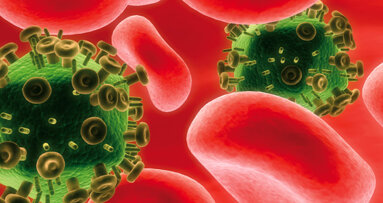 US boosts HIV research at NYU College of Dentistry