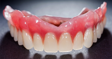 Betrugsprozess um Zahnprothese