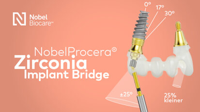De NobelProcera® Zirconia Implant Bridge