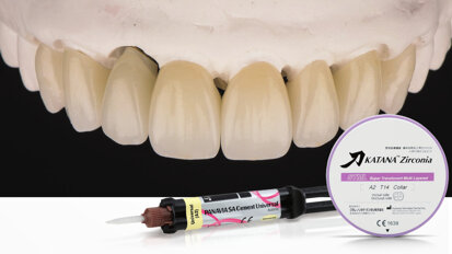 How to cement restorations made of high-translucency zirconia