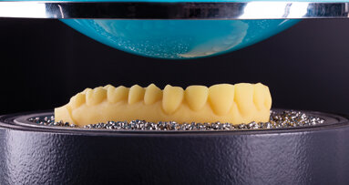 3D tisk ve stomatologii: Požadavky na materiály a zpracování