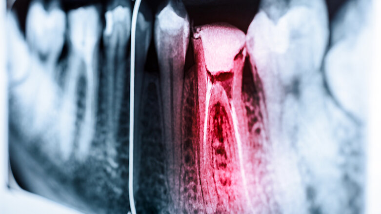 Researchers plan to develop smartphone sensor to detect tooth pain