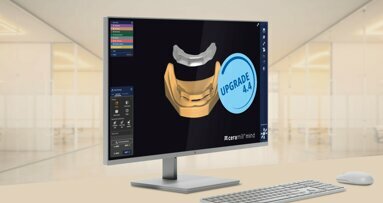Ceramill software Upgrade 4.4 focuses on time-savings and expands indications