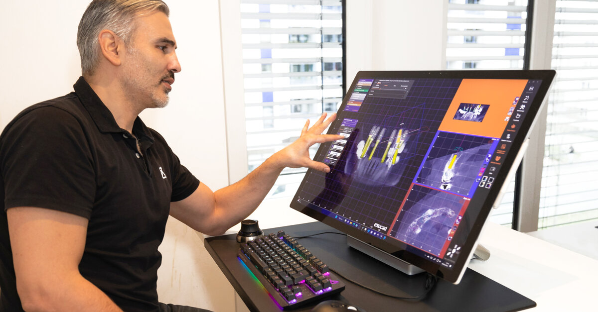 DT News - International - Exocad releases new versions of its chairside ...