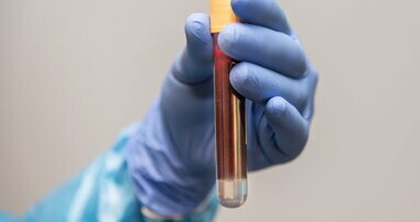 Po raz pierwszy podano ludziom krew wytworzoną w laboratorium