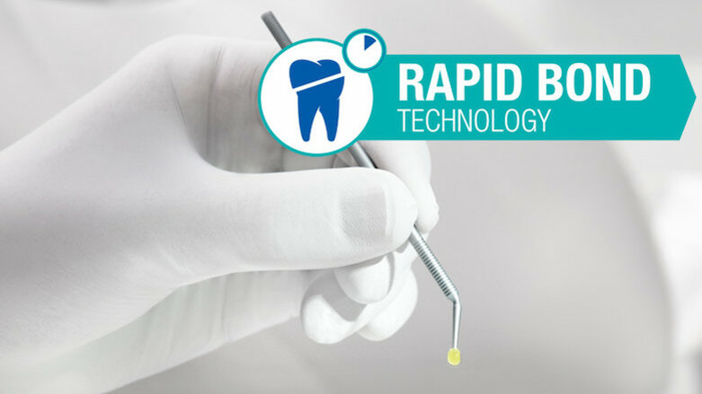 How rapid bond technology changes universal dental bonding agents