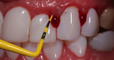 La tecnificación de la odontología