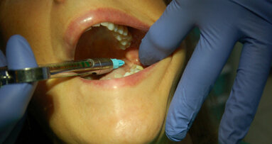 L’estrazione dentale: un atto da non sottovalutare