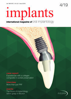 implants international No. 4, 2019