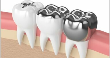 NGO releases briefing about phasing down dental amalgam