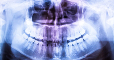 Dentists with greater financial incentive take more radiographs
