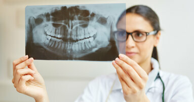 Dental imaging market: Product innovation to stimulate demand