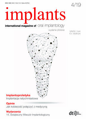 implants Poland No. 4, 2019
