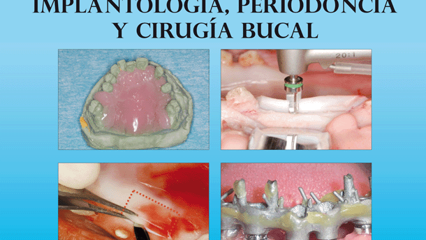 Imprescindible Guía de Implantología, Periodoncia y Cirugía Bucal