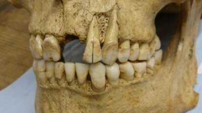 Research uses dental plaque to uncover potential for insights into ancient diets