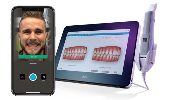 Interview: Benefits of Invisalign Smile Architect
