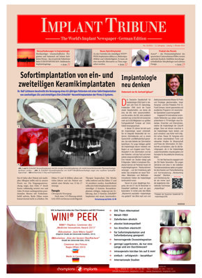 Implant Tribune Germany No. 1, 2014