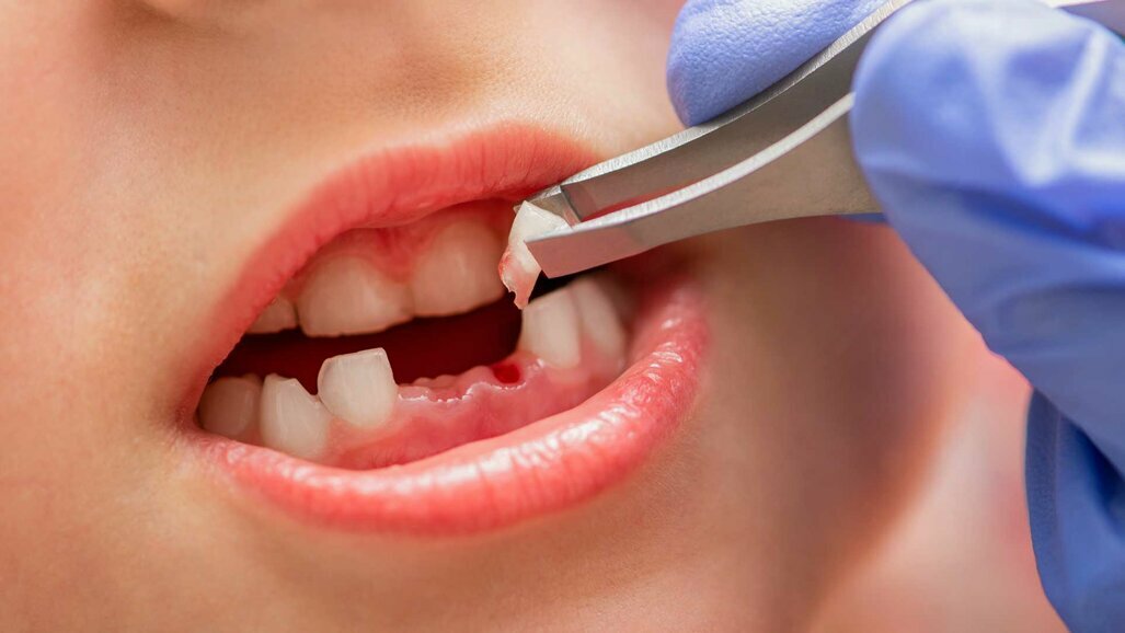 Zahnärzte leisten bei seltener Krankheit Detektivarbeit